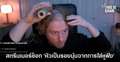 สตรีมเมอร์ช็อก 'หัวเป็นรอยบุ๋มจากการใส่หูฟัง'