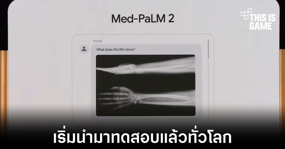 Google เริ่มทดสอบแชทบอททางการแพทย์แล้วทั่วโลก 1 Google เริ่มทดสอบแชทบอททางการแพทย์แล้วทั่วโลก
