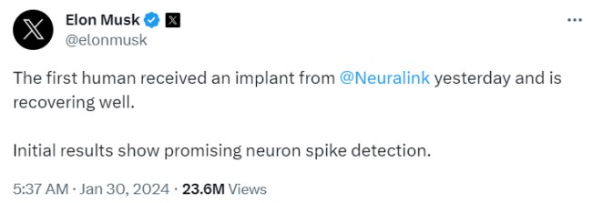 Neuralink ประสบความสำเร็จในการฝังชิปเข้าสู่ร่างกายมนุษย์ 2 Neuralink ประสบความสำเร็จในการฝังชิปเข้าสู่ร่างกายมนุษย์