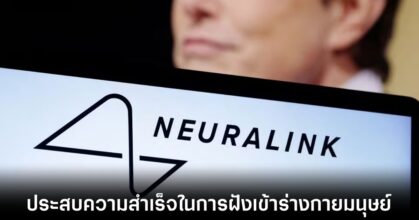 Neuralink ประสบความสำเร็จในการฝังชิปเข้าสู่ร่างกายมนุษย์