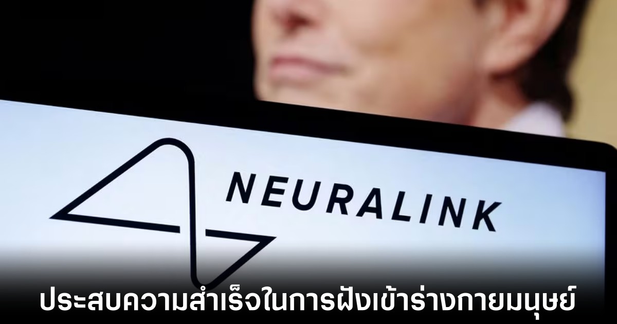 Neuralink ประสบความสำเร็จในการฝังชิปเข้าสู่ร่างกายมนุษย์ 1 Neuralink ประสบความสำเร็จในการฝังชิปเข้าสู่ร่างกายมนุษย์