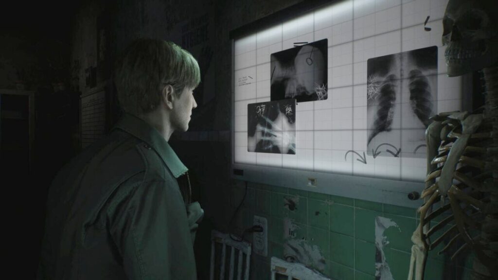 ผู้พัฒนาเผยสาเหตุที่รีเมค Silent Hill 2 ก่อนภาคแรก 2 Silent Hill 2