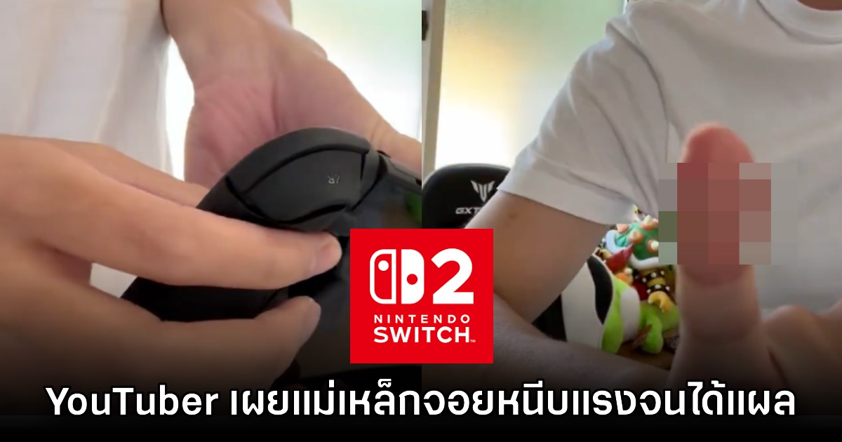YouTuber ญี่ปุ่นเตือน แถบแม่เหล็ก Nintendo Switch 2 หนีบแรงจนบาดเจ็บ