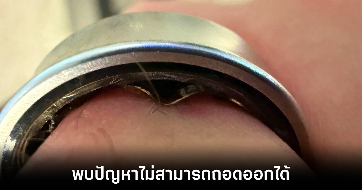 samsung-galaxy-ring-swollen-fraud