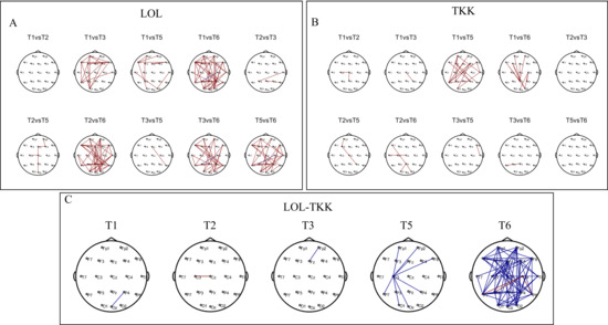 งานวิจัยชี้! เล่น League of Legends วันละ 1 ชั่วโมง ช่วยพัฒนาสมองได้จริง